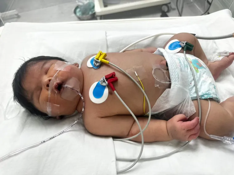 infaq sedekah untuk bayi sakit jantung berlubang - PULAU PINANG, 5 Jun 2023 : Seorang bayi lelaki berusia 9 hari memerlukan kira-kira RM70,000 bagi menampung kos pembedahan dan rawatan penyakit jantung berlubang, saluran jantung sempit dan dinding jantung bocor yang dihidapinya. Aftab Gabriel Raees, dikesan menghidap masalah jantung berlubang, saluran jantung sempit dan dinding jantung bocor selepas mempunyai masalah kesukaran bernafas kira-kira dua hari selepas dia dilahirkan. - INFAQ SEDEKAH WAKAF BANTU BAYI SAKIT DI MALAYSIA